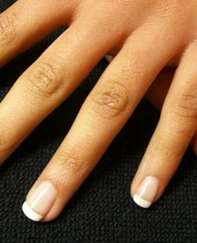 Méthodes pour blanchir ses ongles