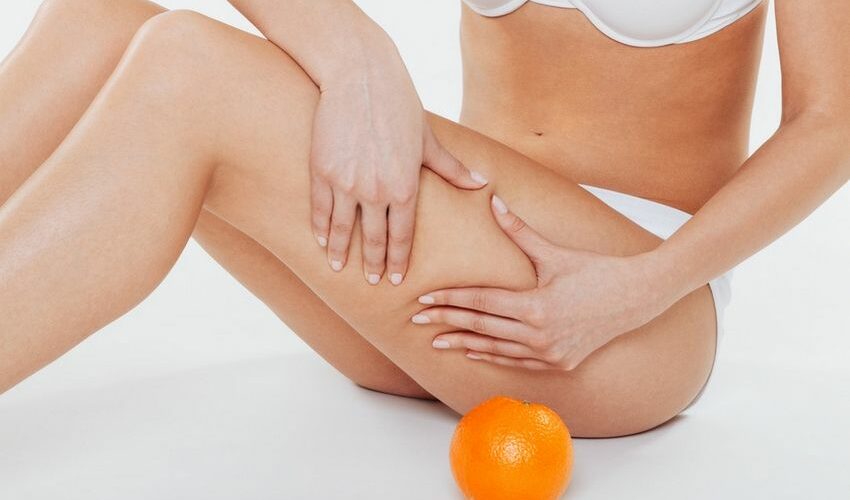 Tout connaître sur la cellulite