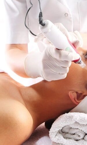 Tous savoir sur le microneedling