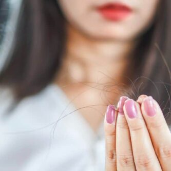 Alopécie : tout savoir sur cette perte de cheveux soudaine 