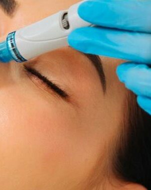 Conseils sur le soin hydrafacial