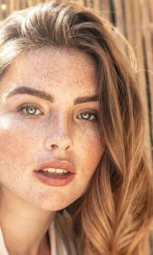 6 produits qui éliminent les taches pigmentaires très facilement