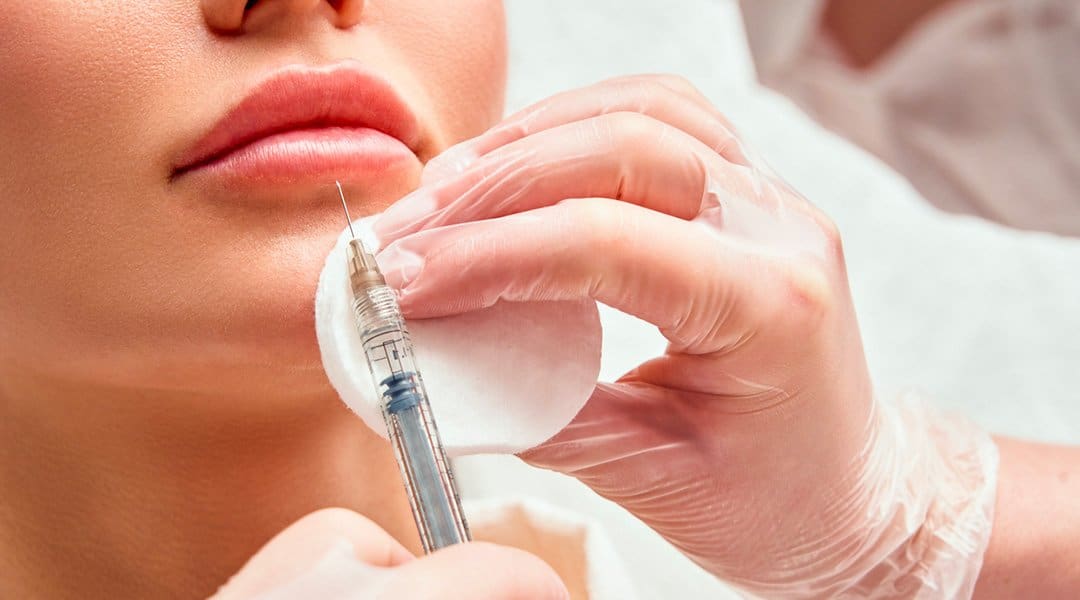 injection de toxine botulique dans les lèvres