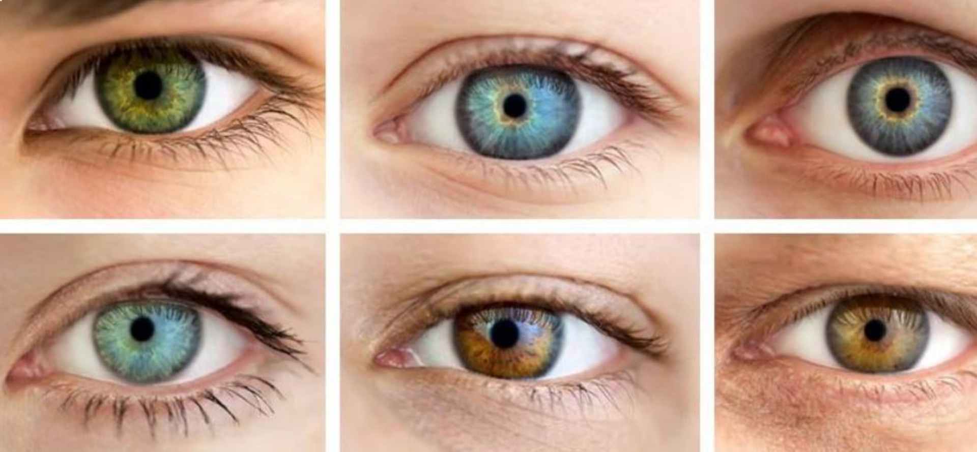 couelur des yeux possible par kératopigmentation